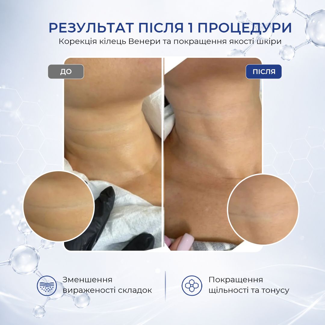 До процедуры