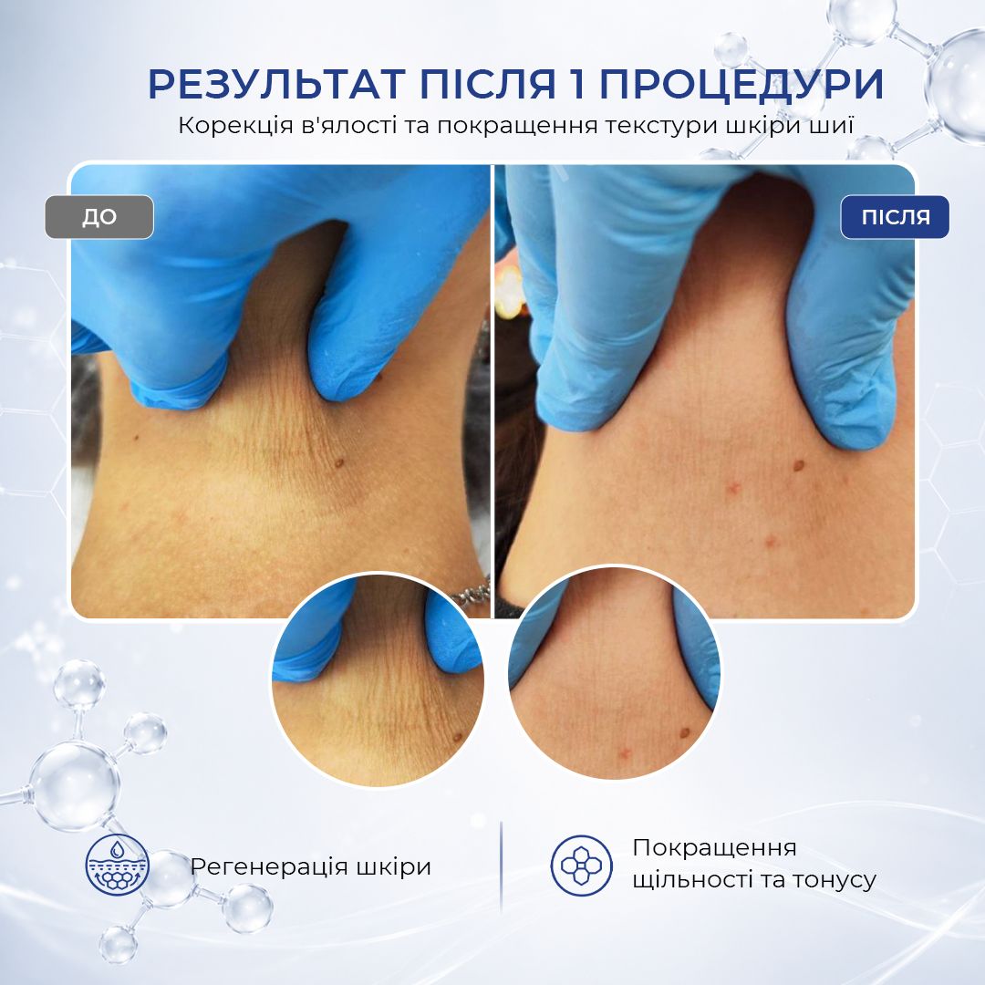 До процедуры