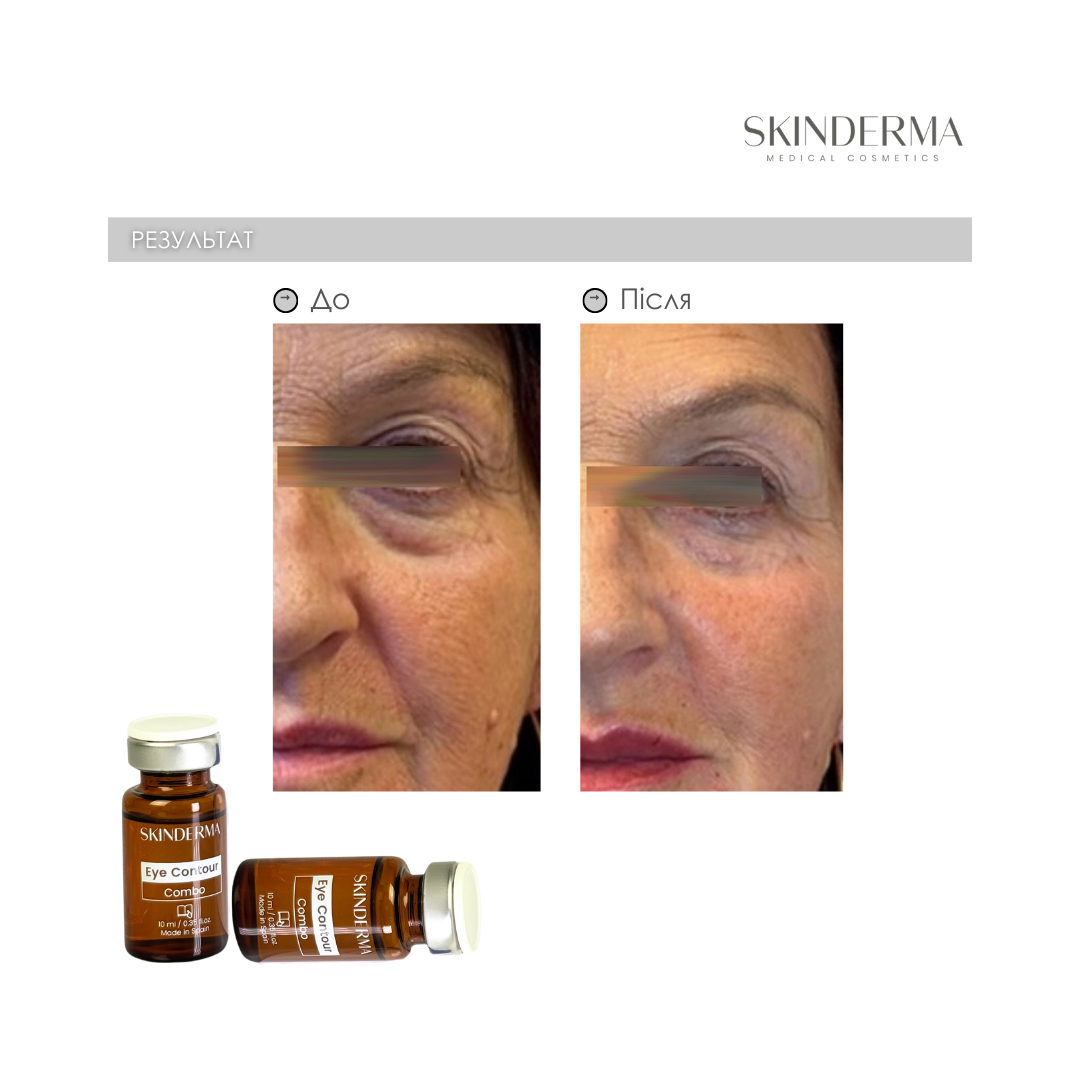 До процедуры