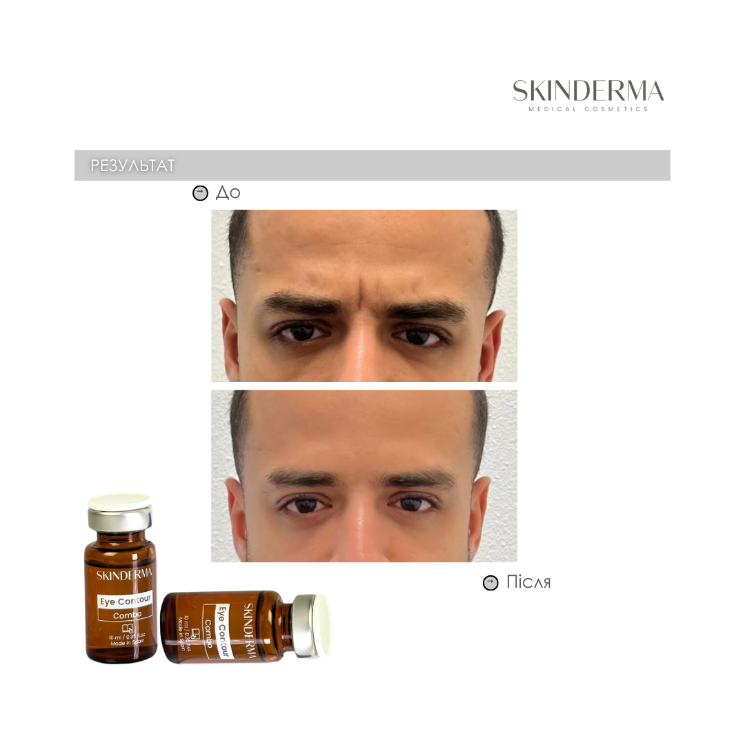 До процедуры