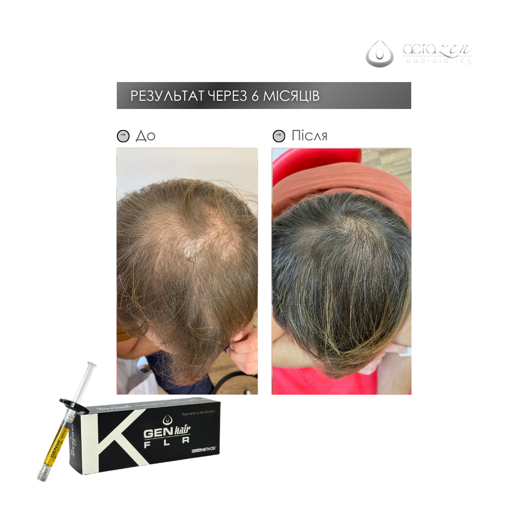 До процедуры