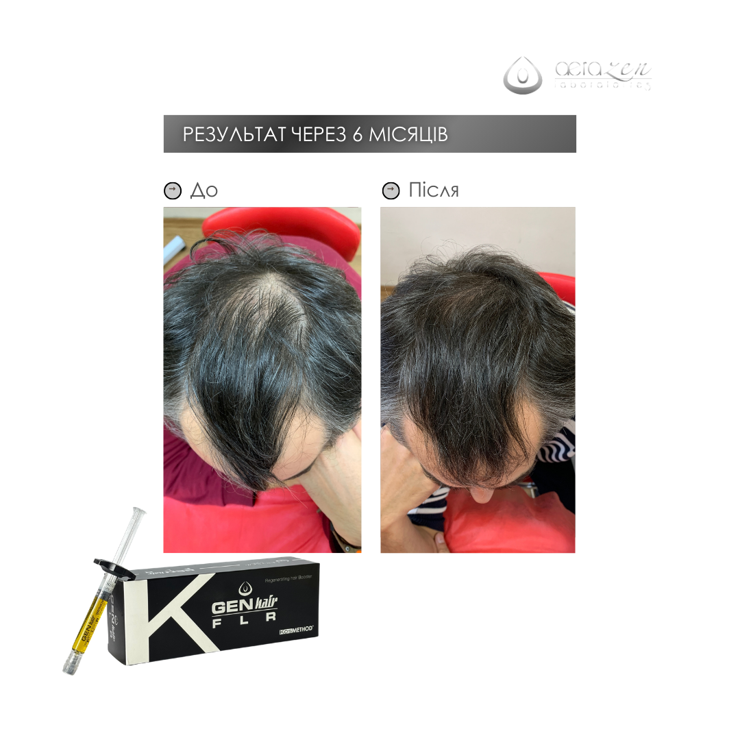 До процедуры